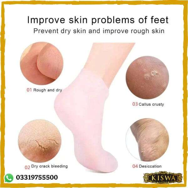 Silicone Moisturizing Socks for Women – Soft Gel Heel Care Socks, Cracked Heel Repair & Foot Hydration